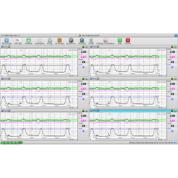 Logiciel PC MFM-CNS Lite pour cardiotocographe Edan F3