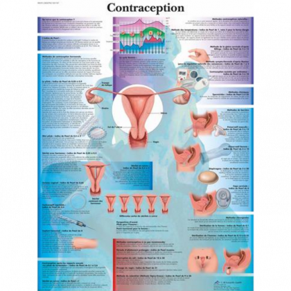 Planche anatomique - La contraception