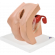 Modèle anatomique de gynécologie pour explication aux patientes - 3B Smart Anatomy